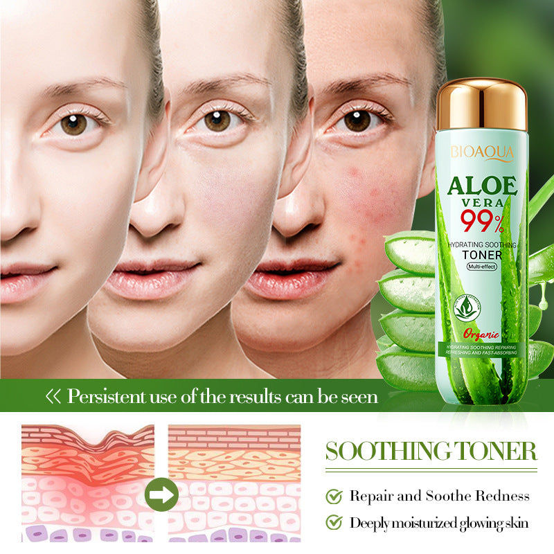 Tonico facial de aloe vera 99% BIOAQUA REF:NO.BQY14733